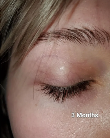 Eye Lash Growth