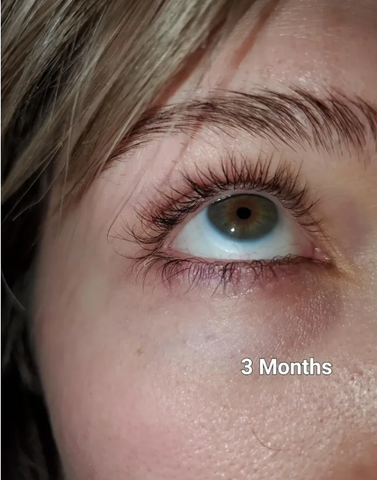 Eye Lash Growth